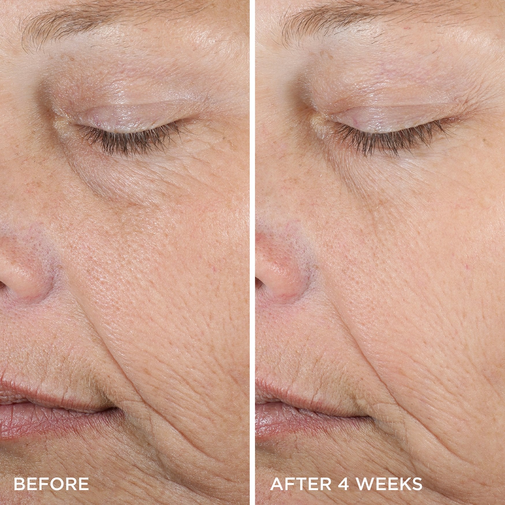 DewySerum-pdp-BeforeAfter-1200x1200-1.jpg