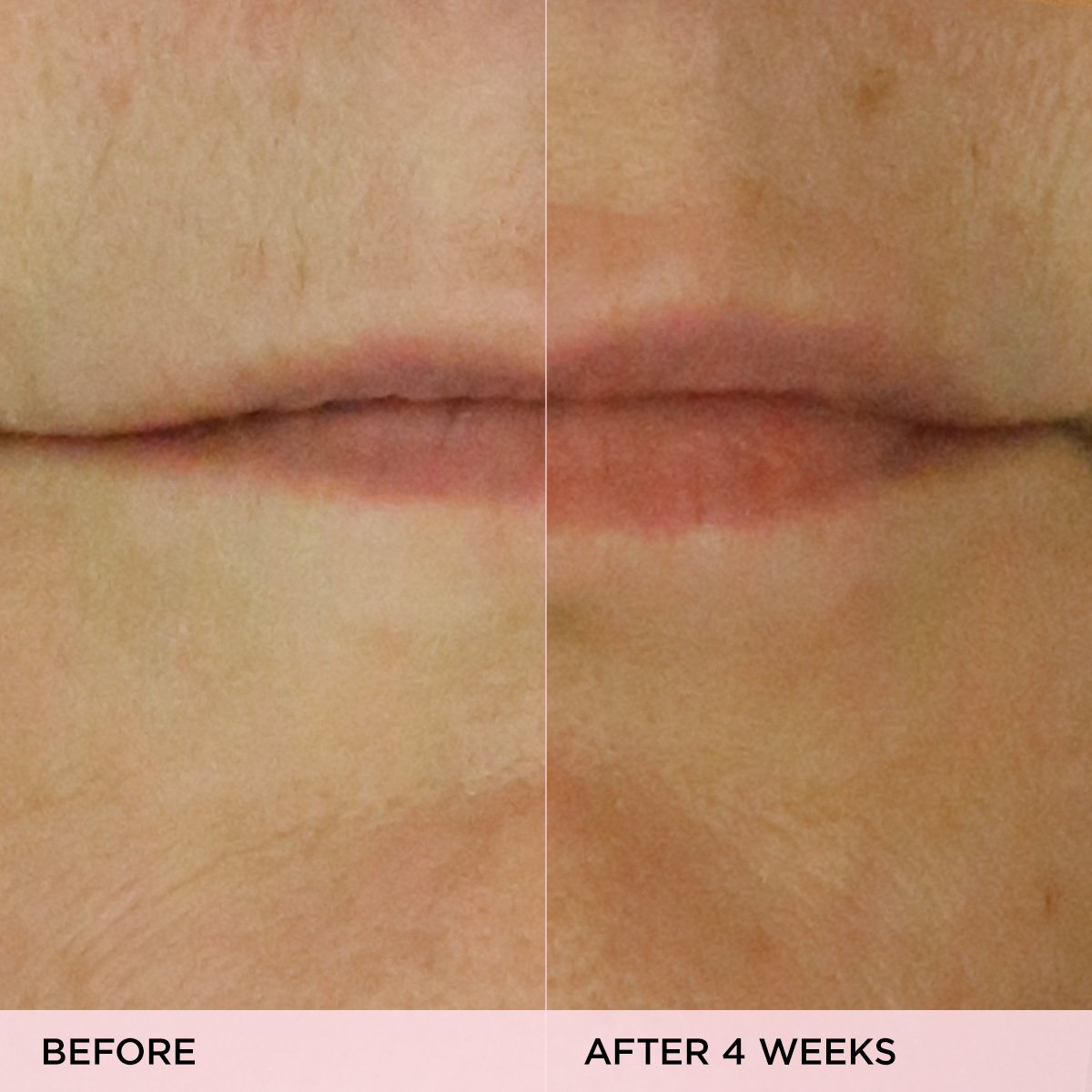 KissuLipTreatment-pdp-Clinicals-1200x1200-1.jpg